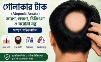অ্যালোপেসিয়া এরিয়াটা রোগে মাথায় গোলাকার টাক এবং তার চিকিৎসা